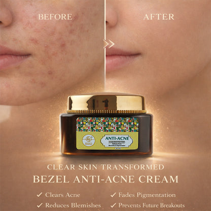 Bezel™ Anti Acne Combo Pack (Anti Acne Foaming Facewash & Anti Acne Face Cream)